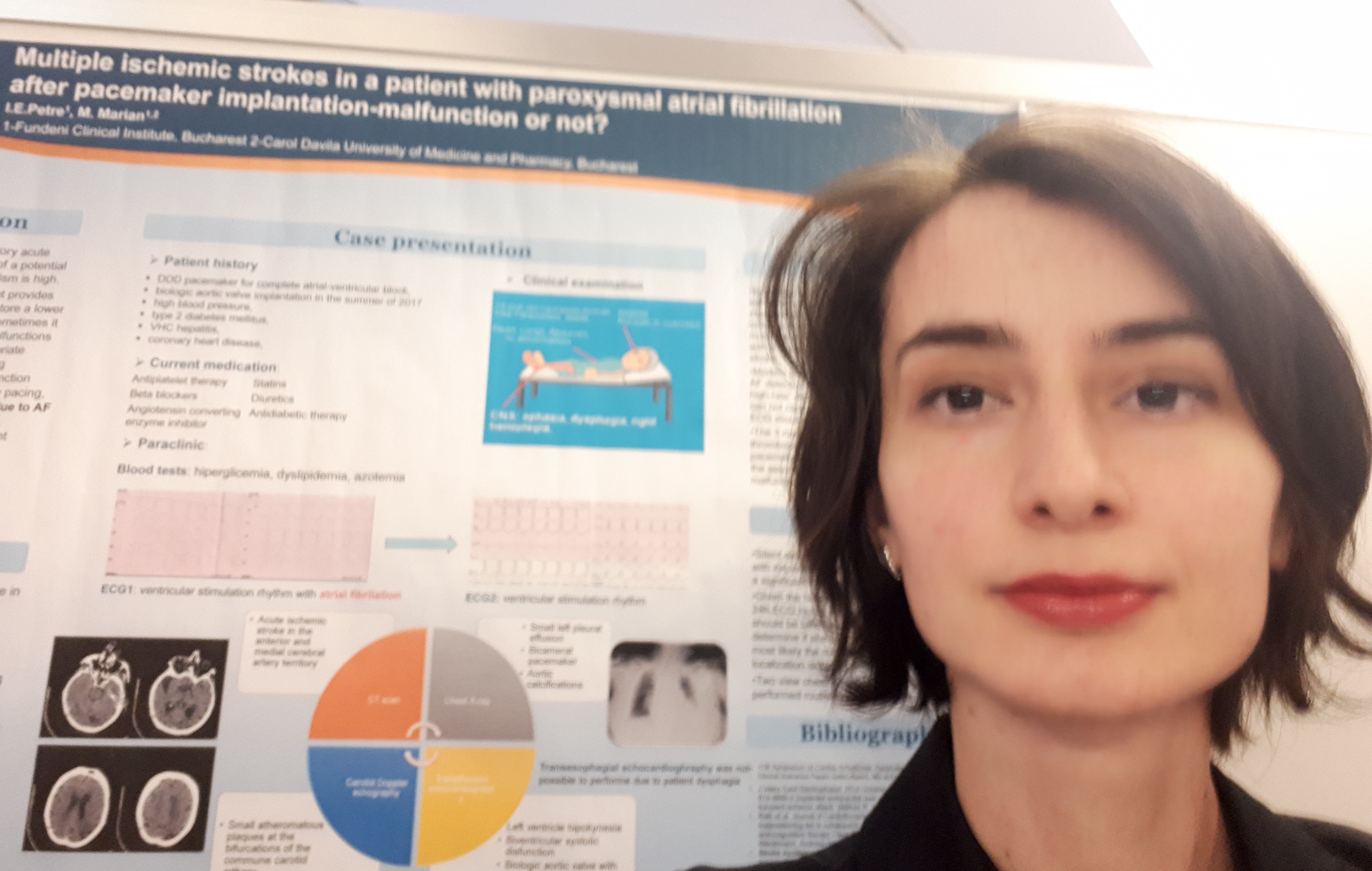 Dr. Iulia Petre, medic neurolog, își prezintă publicația științifică „Multiple ischemic strokes in a patient with paroxysmal atrial fibrillation after pacemaker implantation” la European Society of Cardiology Conference din Berlin